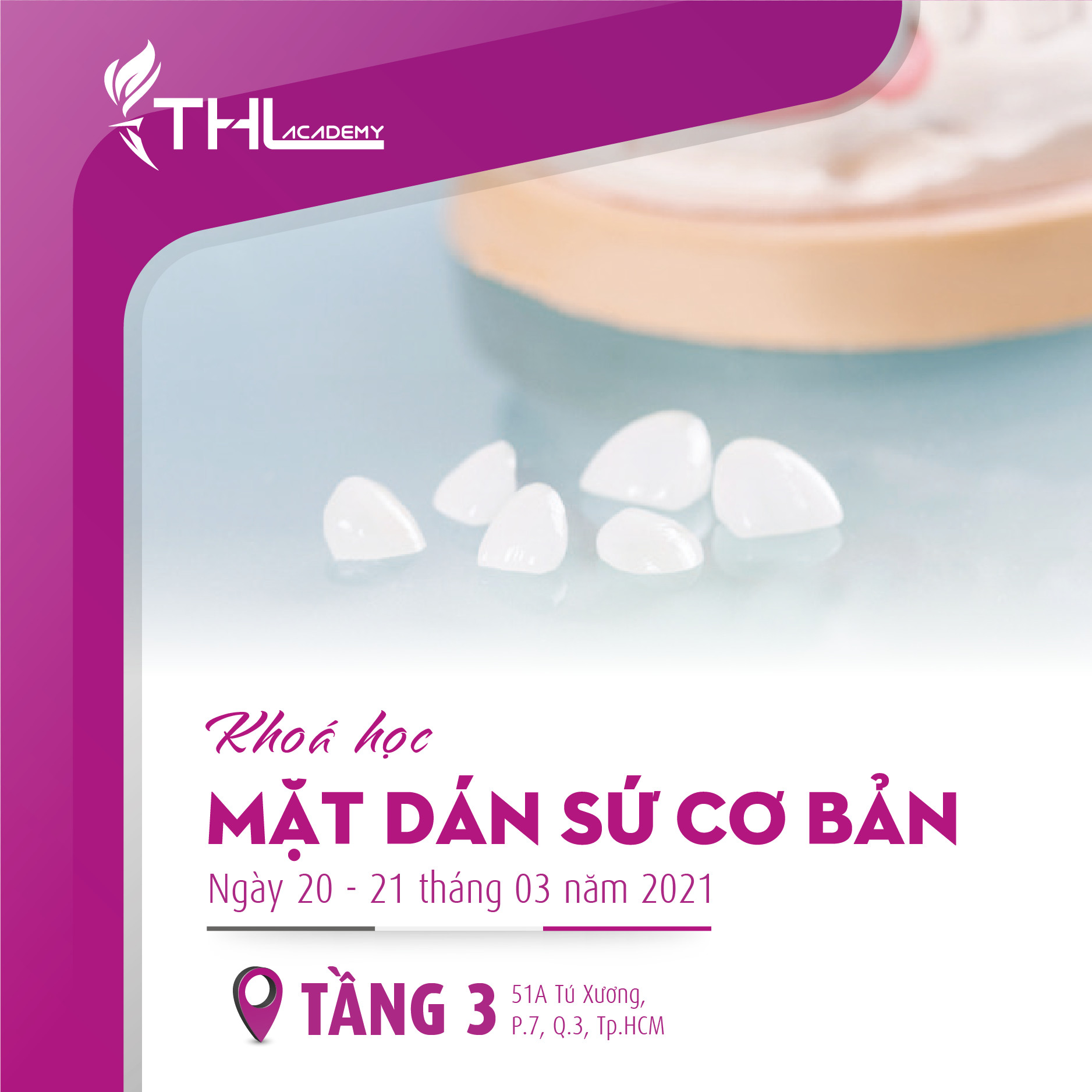 ảnh Lớp Mặt Dán Sứ